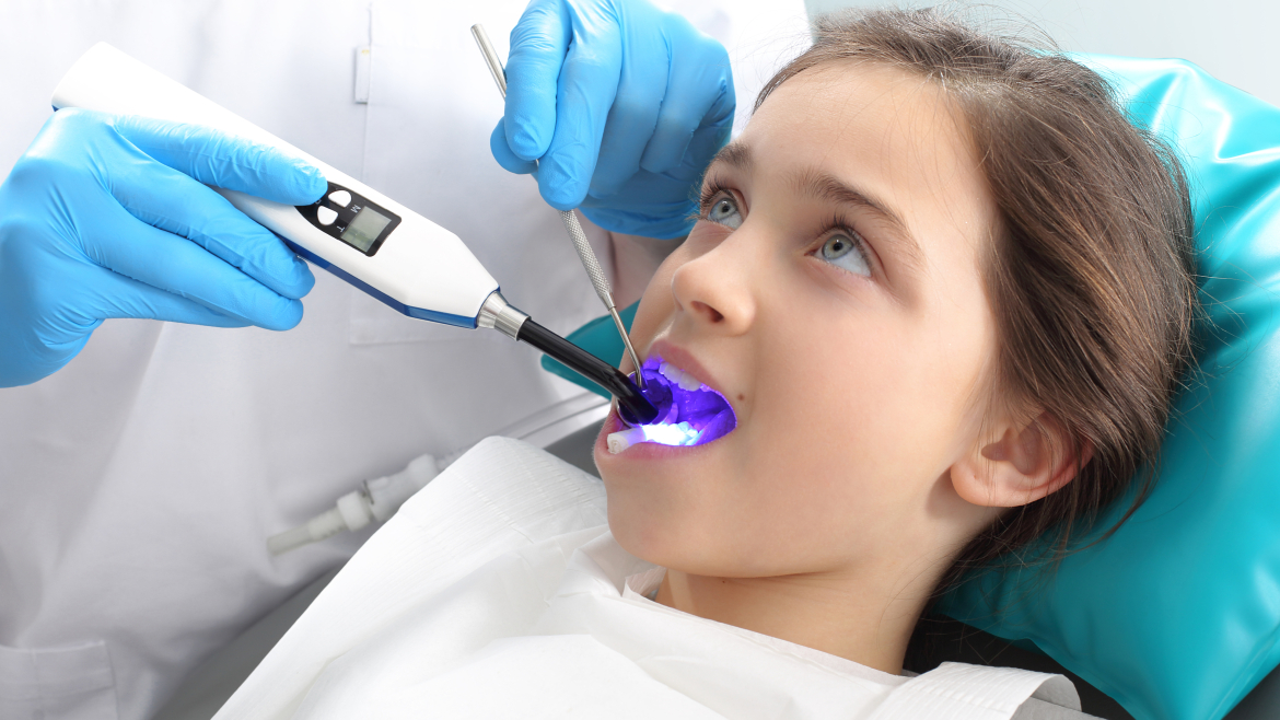 La importancia de los selladores dentales en niños
