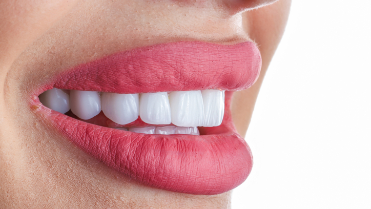 Cómo elegir el tratamiento estético adecuado según tu sonrisa