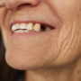 ¿Puede la pérdida dental afectar la forma del rostro?